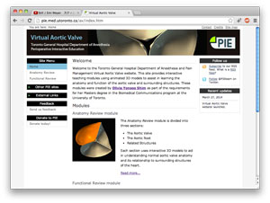 screen capture of Virtual Aortic Valve web page